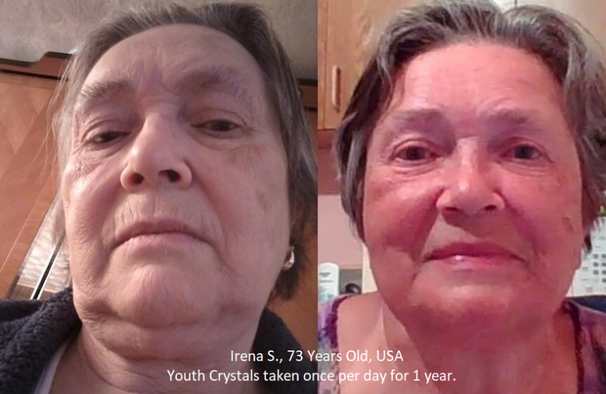celluvation youth results